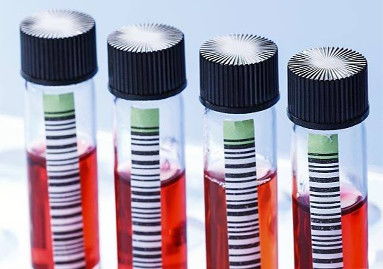 生物制品冷库安装的制冷设备造价是多少